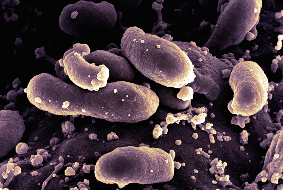 Drug-Resistant Fungus Candida auris Reported in Nearly Half of U.S. States This Year